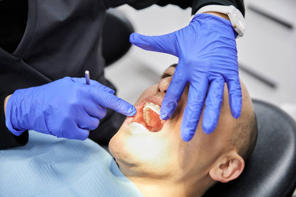 Best Chipped Tooth Repair Near Me  in Val Verde Park, TX